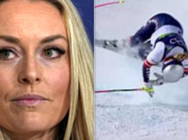 Ліндсі Вонн Ділиться Графічним Знімком Рентгена Після Олімпійської Аварії, Розповідає про Відновлення, що Продовжується