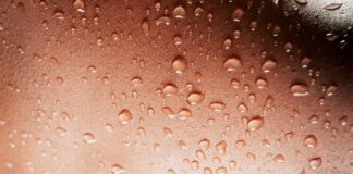 Fortschrittliche Akne-Pflaster zeigen in ersten Versuchen vielversprechende Ergebnisse