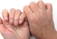 Чому свербить шкіра і як припинити свербіж, не розчісуючи її