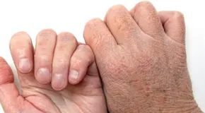 Why your skin itches and how to stop itching without scratching